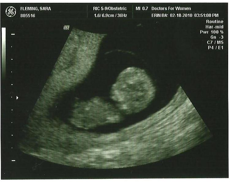 [Ultrasound+3-1.jpg]