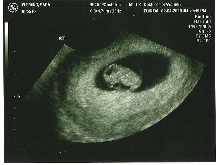 [Ultrasound+2.jpg]