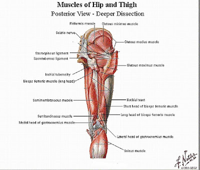 Steroids for sciatic nerve pain