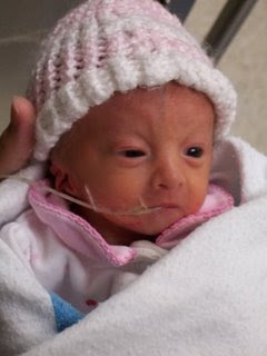 Edwards Syndrome