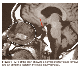 Wealth lab 4 скачать