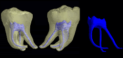 Conductos de un Molar