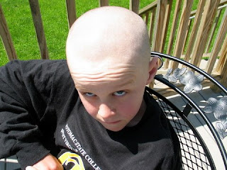 Bald Gnome