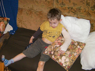 the patient, boy with a broken arm