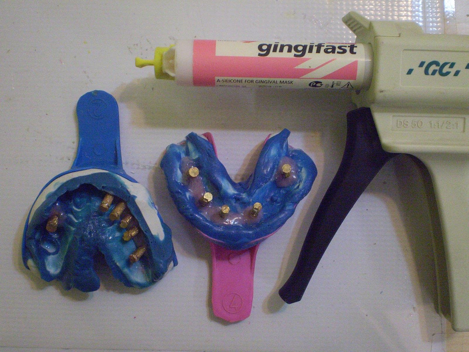 academy dental lab full case implantimpression,gingiva mask and cast