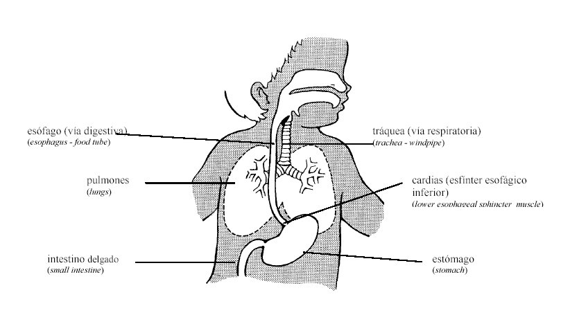 [anatomia+del+reflujo.bmp]