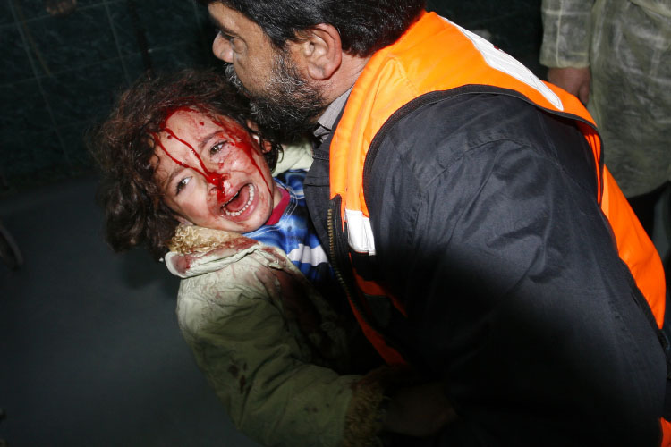 [Ein+verletztes+Mädchen+wird+von+Rettungskräften+ins+al-Shifa+Krankenhaus+gebracht..jpg]