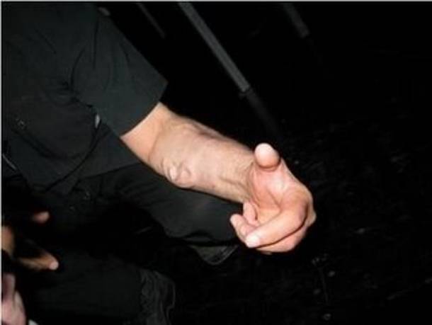 [earinhand.jpg]