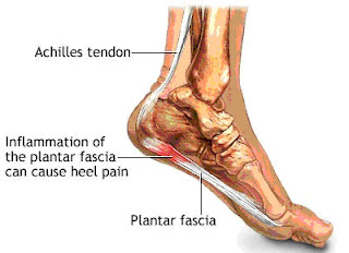 Foot illustration showing the achilles tendon and plantar fascia