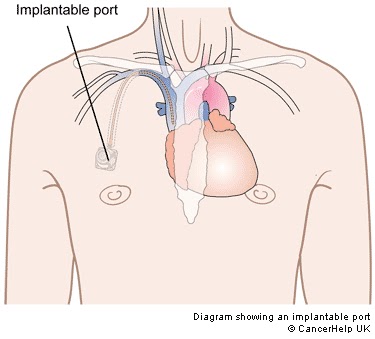 clavicle vein