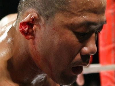 10 MMA Photos That Will Scare Your Children and Make You Cry Earoff