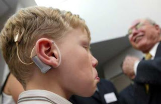 பயோனிக்ஸ் எனும் அறிவியல் அற்புதம் Cochlear+Implant