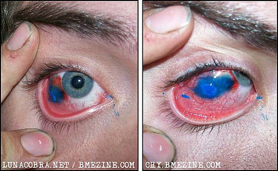 All sEEing EyE EyElid tattOO. Eyeball Tattoos Banned in Midwest State!