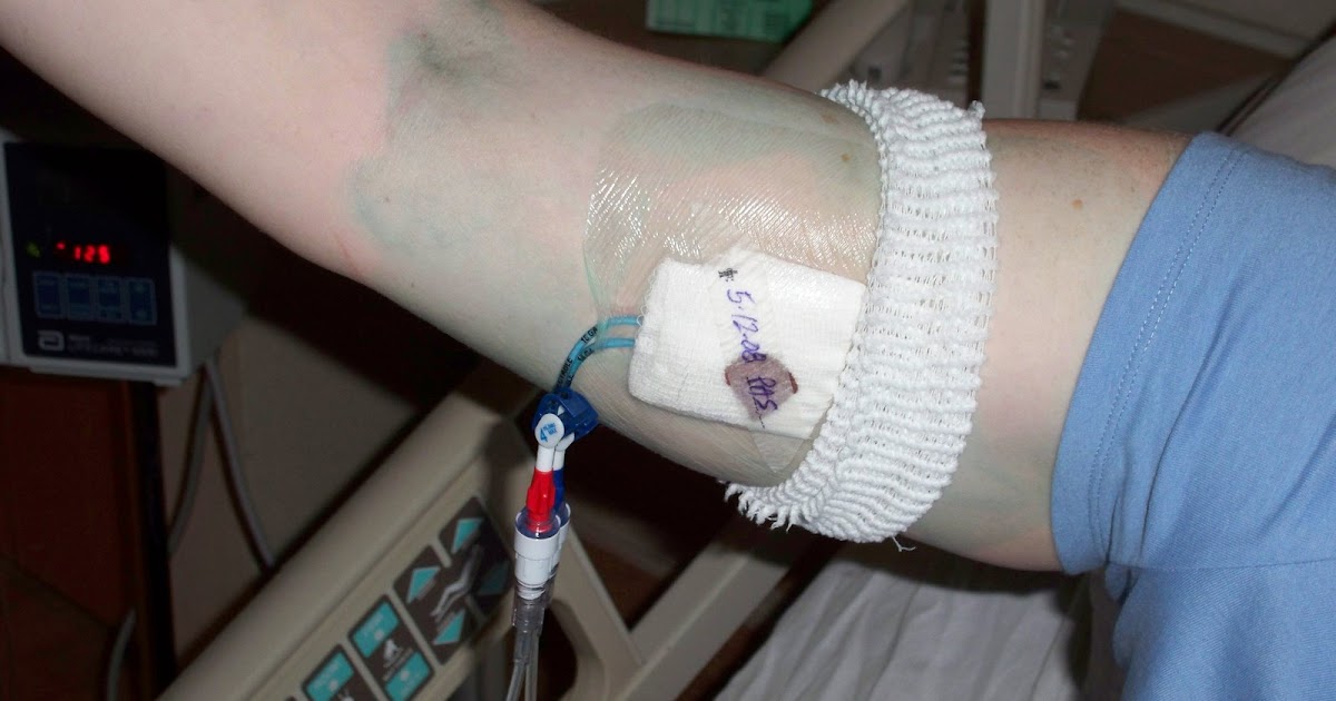 With God, WE WILL BEAT THIS!!! PICC, Pumps, Lumbar Puncture and Chemo