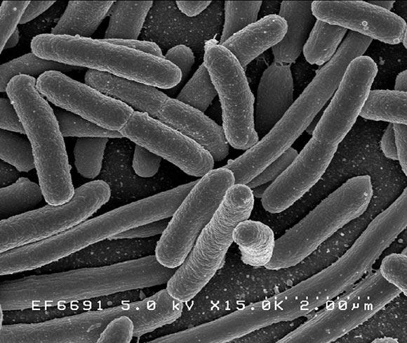 [e_coli_580x.jpg]