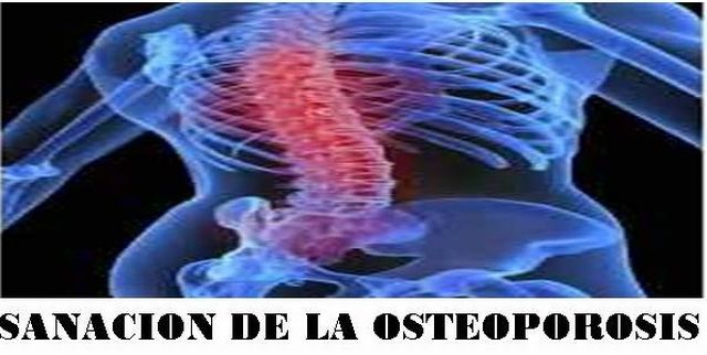 curacion de la osteoporosis