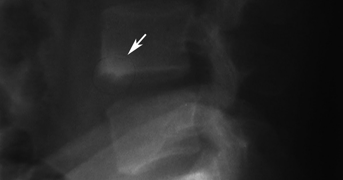 Radiodiagnosis Imaging is AmazingInteresting cases Shiny corner