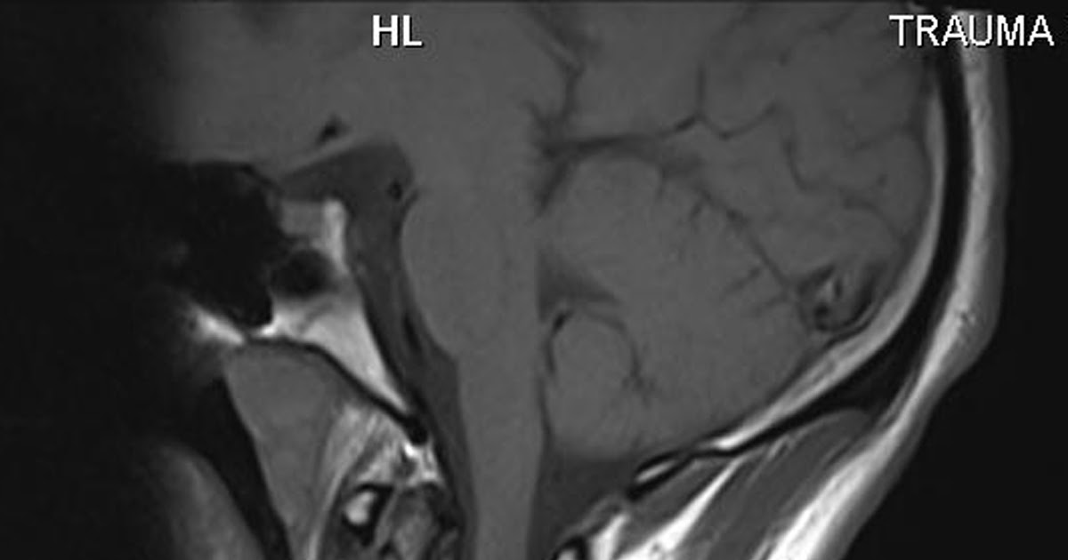 Radiodiagnosis Imaging is AmazingInteresting cases Fracture of the