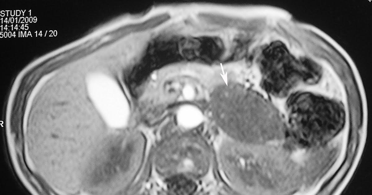 Radiology Books  Blogspot Radiology Books  Blogspot