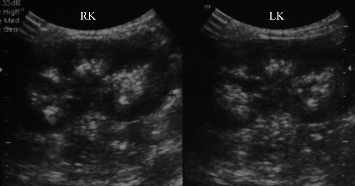 Radiodiagnosis Imaging is AmazingInteresting cases Medullary