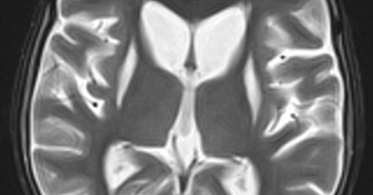 Radiology Books  Blogspot Radiology Books  Blogspot