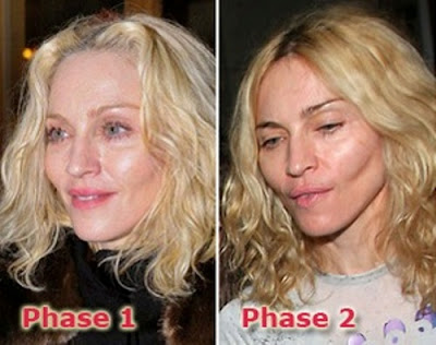 Madonna Plastic Surgery on Madonna   S Plastic Surgery Final Look   Funky Downtown