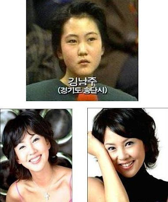 Korean Plastic Surgery on Korean Actresses Before And After Plastic Surgery Photos   Funky