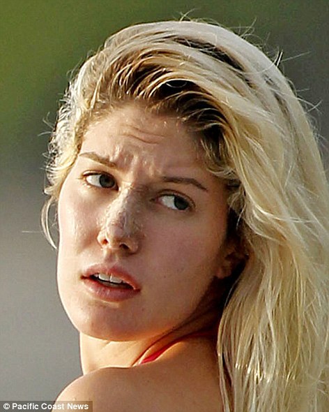heidi montag after surgery heidi montag after surgery people. heidi montag after surgery