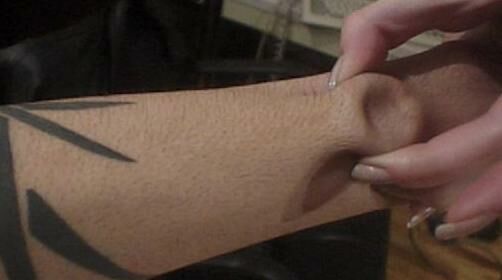[armring.jpg]