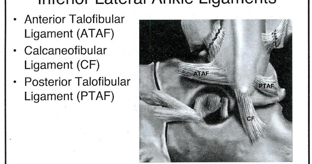 Radiology Cases Lateral and Medial Ankle Ligaments