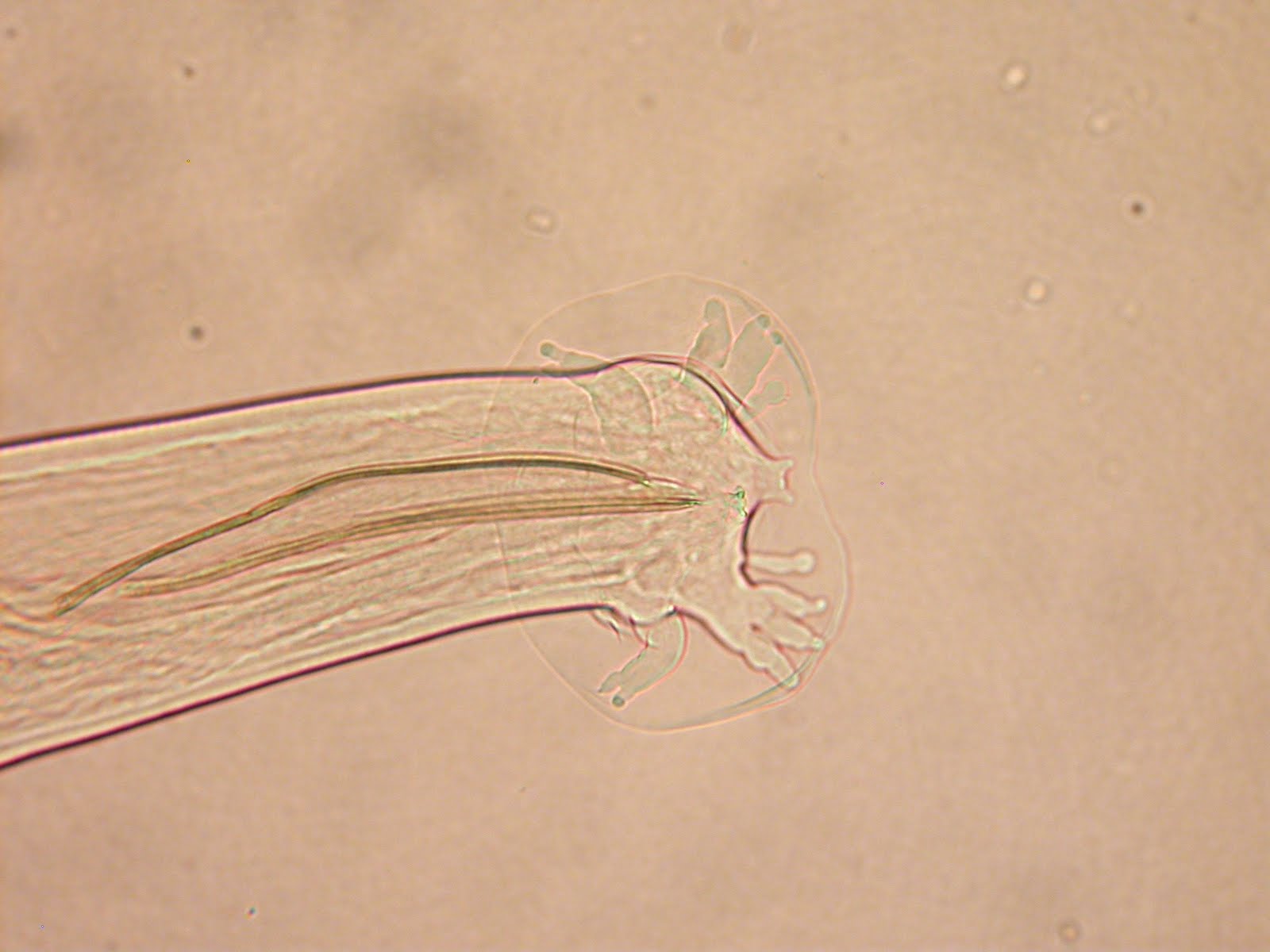 Parasite of the Day April 29 Angiostrongylus costaricensis