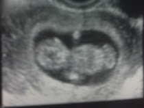 I'm pregnant!  Due September 21, 2010