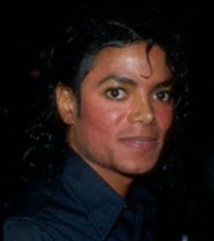 [Michael+vitiligo+6.jpg]