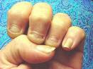 Short+stubby+nails