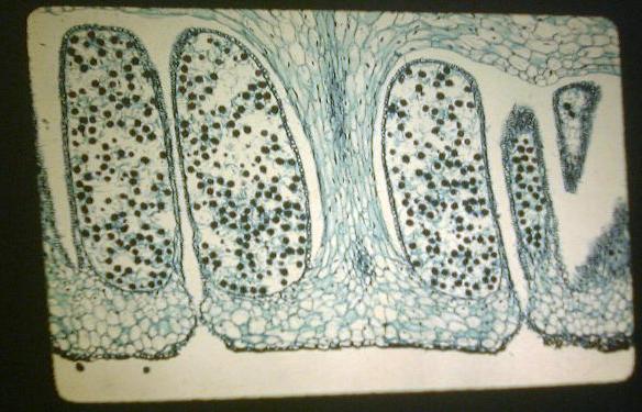 Equisetum (Strobilus)
