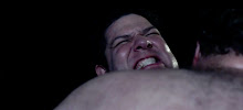 Sumo Joe Fighting For His Life