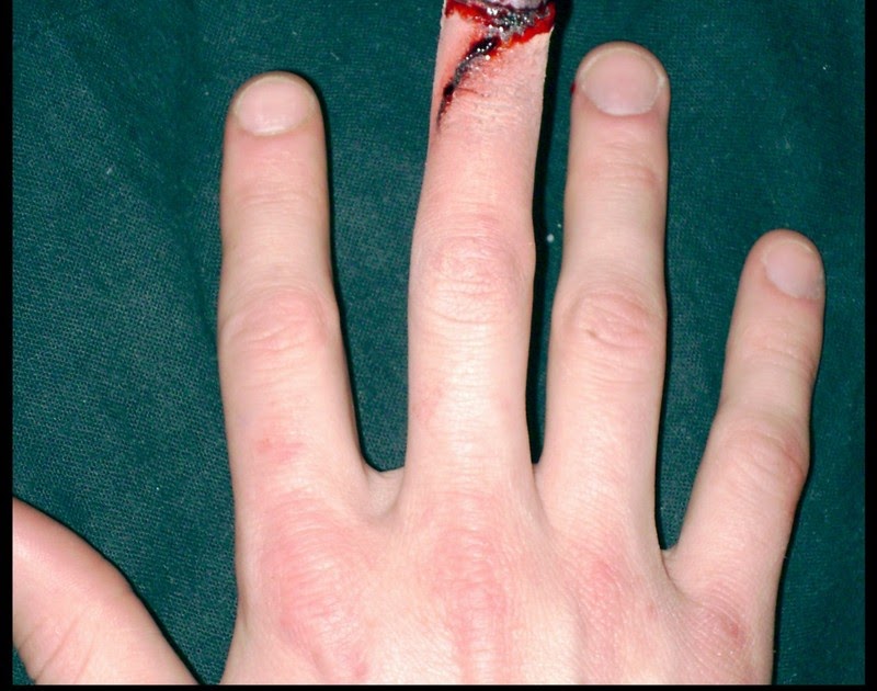 Makeup Artist Jess Robert Broken Nail