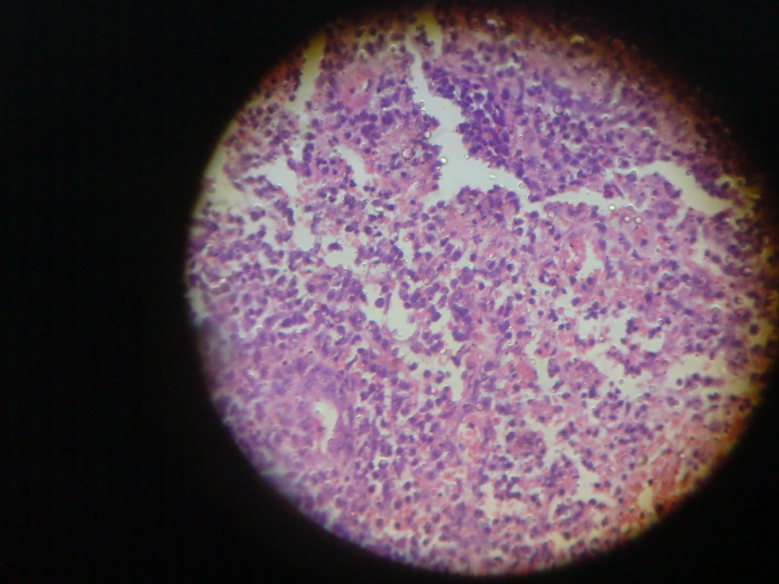 Gandhi Medical College Histopathology Slides PartI