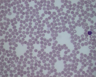 Blood Tissue Pictures