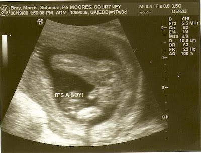 Boy Scan