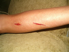 Ferret Attack!