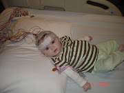 EEG for infantile spasms