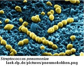 Anaerobic Bacteria In Mouth 58