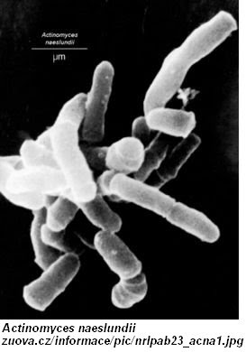 bacteria research paper bacteria research paper