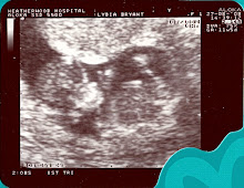 Our First Scan