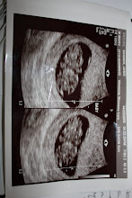 1st Ultrasound 9 weeks