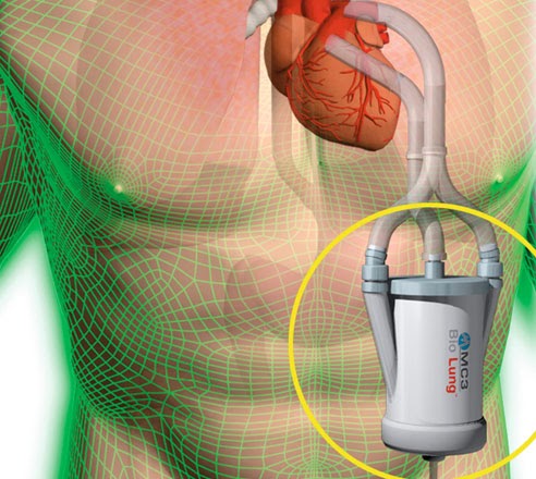 Physiology 101: Artificial Organs