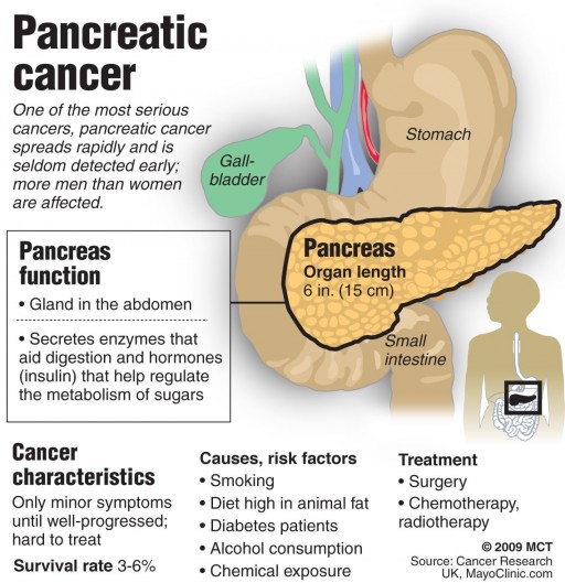 Pkkindia Pancreatic Cancer