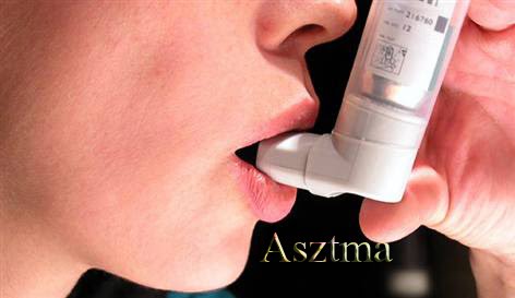 Asztma