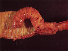 Intusucepción (intestino abierto, canino)